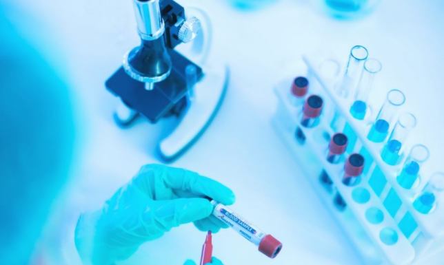 Nowoczesne Zamrażarki ultra Niskotemperaturowe do -86°C od Bolarius - przechowuj próbki w doskonałych warunkach!