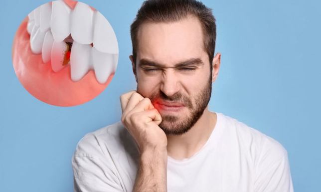 Zapalenie okostnej zęba - objawy, przyczyny i metody leczenia