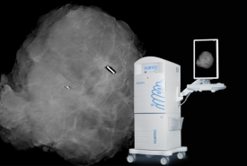  aparat RTG przeznaczony do bardzo dokładnego obrazowania wyciętych tkanek